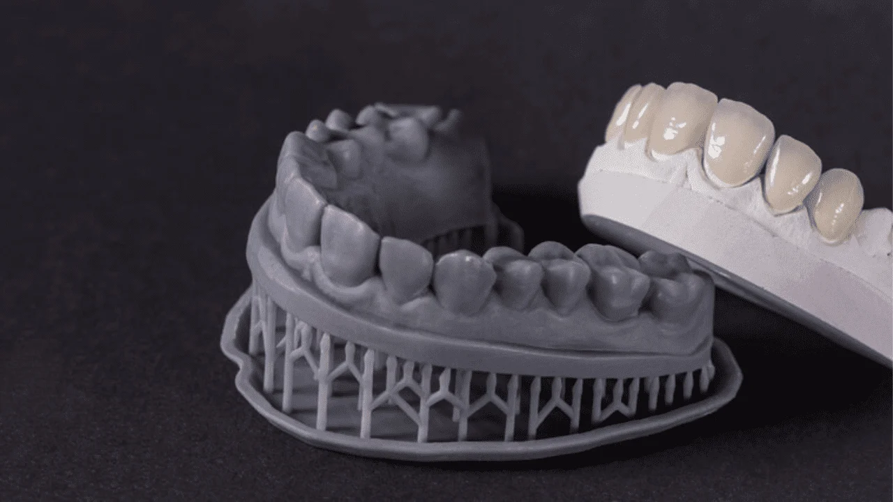 6 Key Benefits of CAD/CAM Dentistry in Dental Restorations