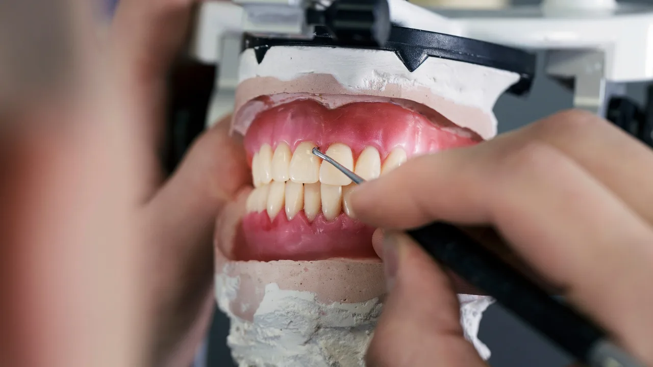 Guide to Dental Cementation Techniques for Durable Restorations