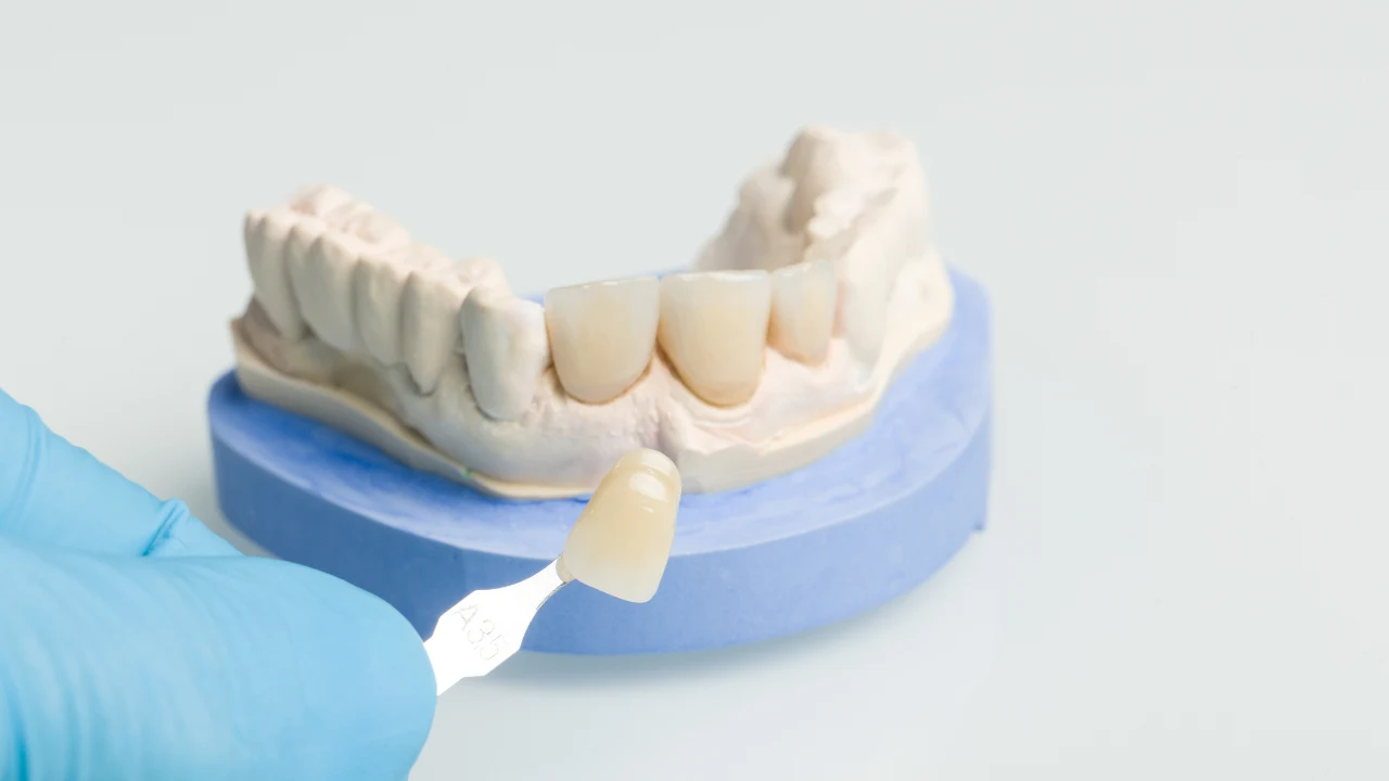 Dental Lab Communication for Exceptional Outcomes