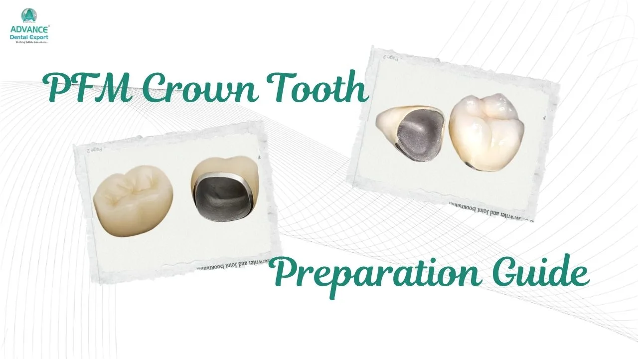 PFM Crown Tooth Preparation: Materials, Procedure & Guideline