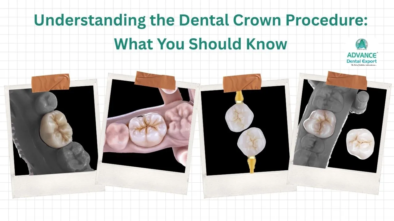 Complete Dental Crown Procedure & Placement Guide for Dentists