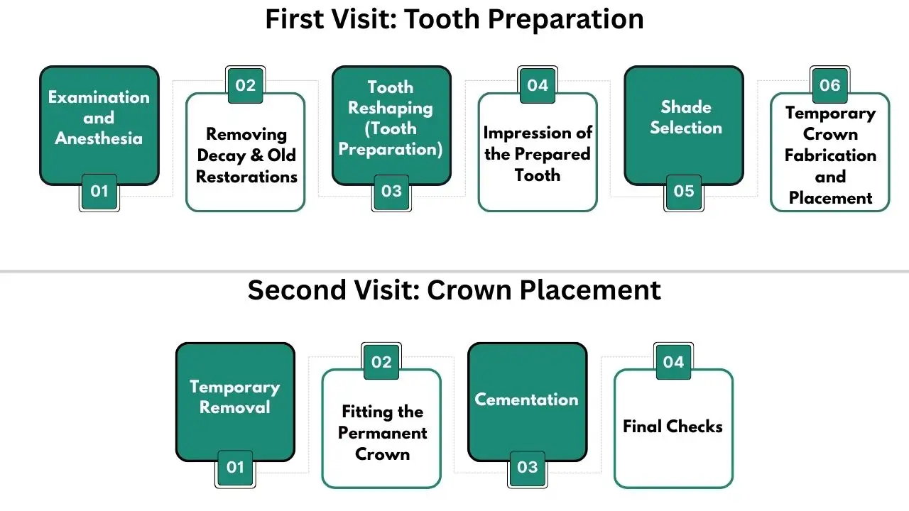 Dental-Crown-Procedure-Step-by-Step