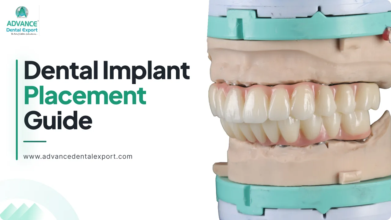 Dental Implant Placement with Digital Dentistry: Procedure