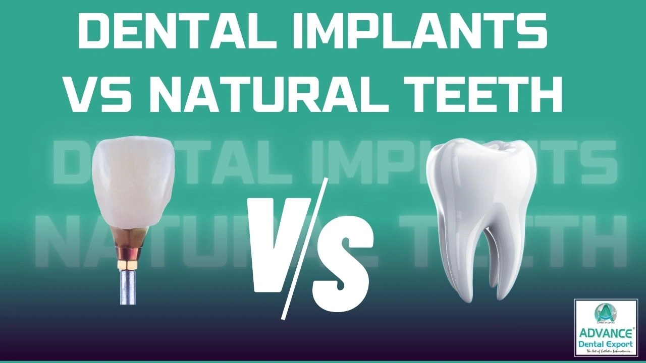 Dental Implants vs Natural Teeth: A Dentist’s Guide