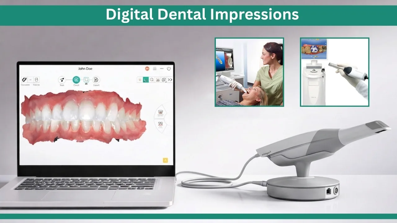Digital-Dental-Impressions