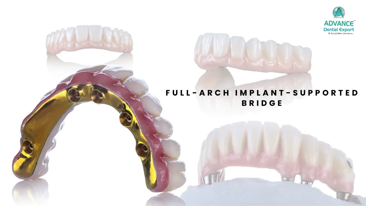 Full-Arch-Implant-Supported-Bridge-All-on-4-All-on-6-Concepts