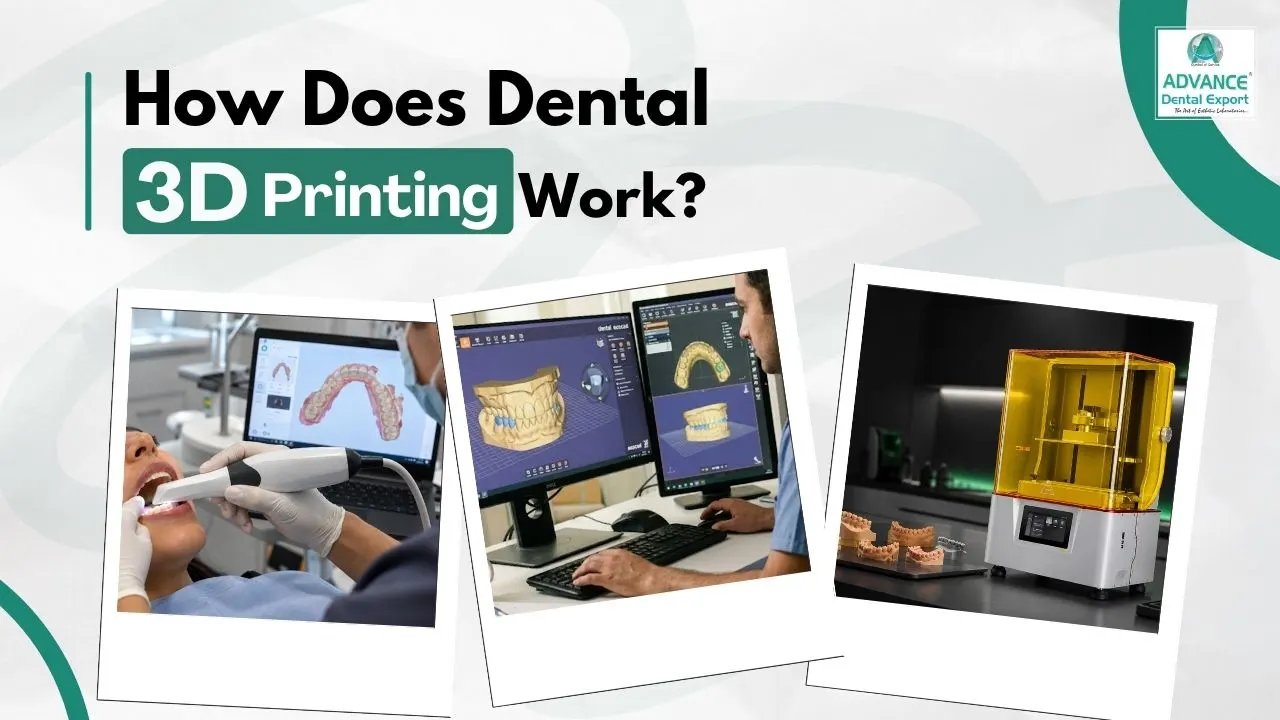 How-Does-Dental-3D-Printing-Work