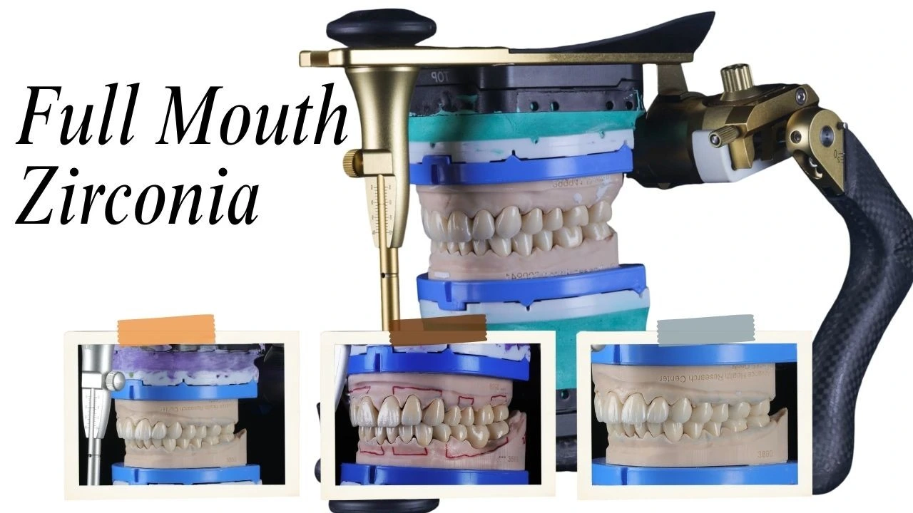How-Much-Does-Full-Mouth-Zirconia-Cost-in-India