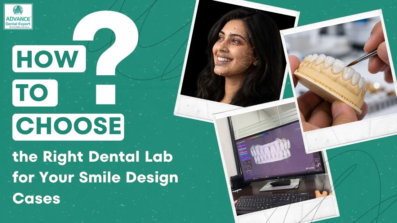 Dental Lab for Smile Design: 6 Checks for Dentists | ADE