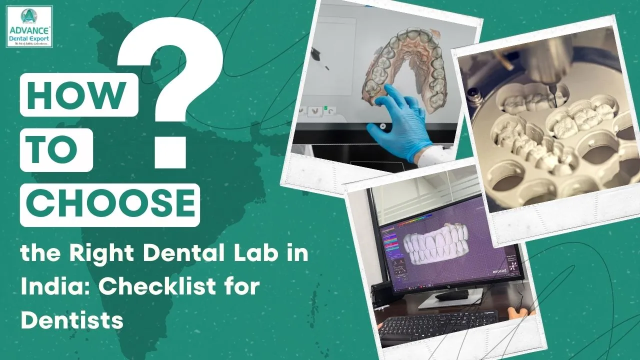 Dentist Checklist: How to Choose the Best Dental Lab in India