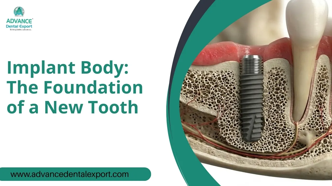 Implant-Body-The-Foundation-of-a-New-Tooth