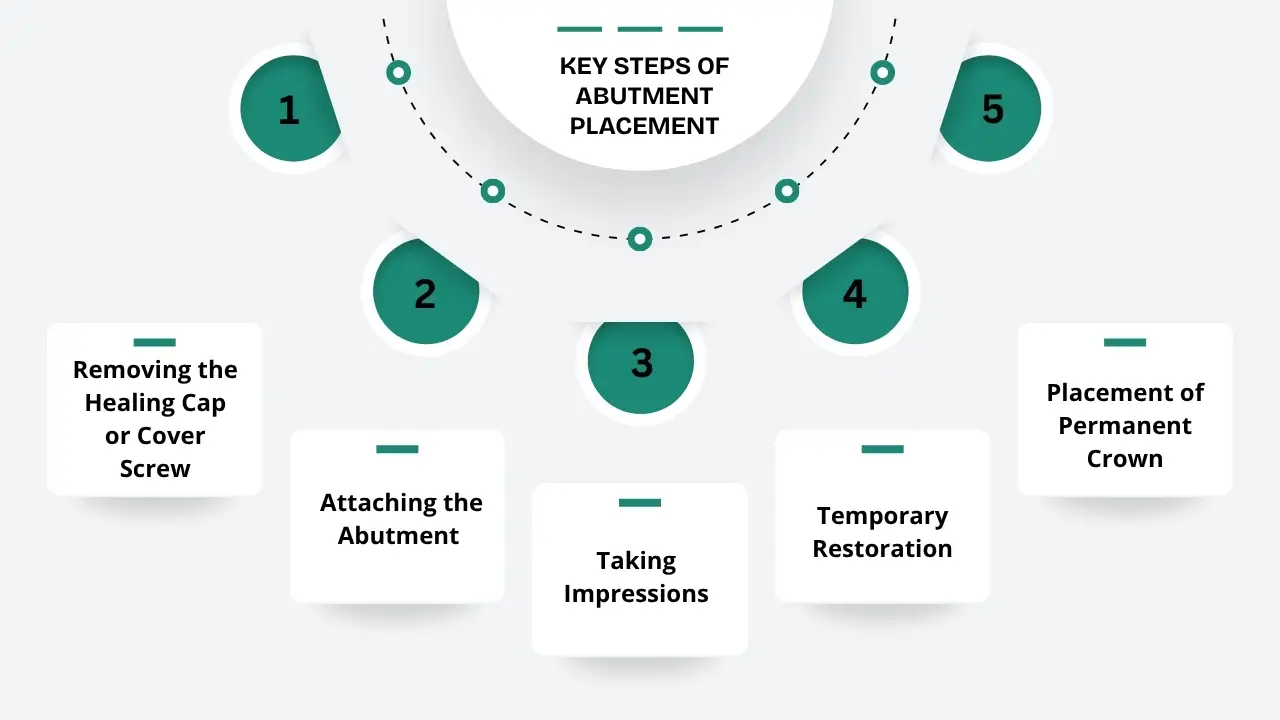 Key-Steps-of-Abutment-Placement