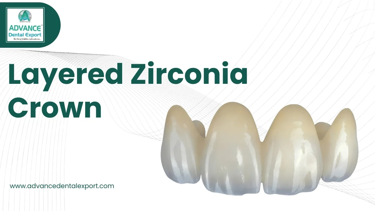 Layered-Zirconia-Crown