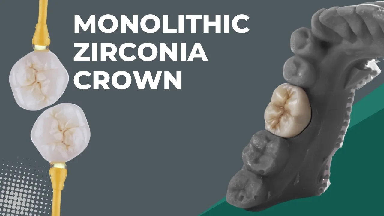 Monolithic-Zirconia-Crown