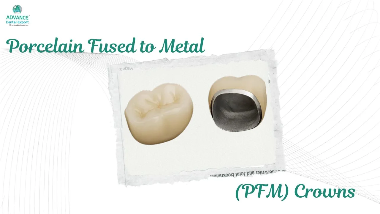 Porcelain-Fused-to-Metal-material
