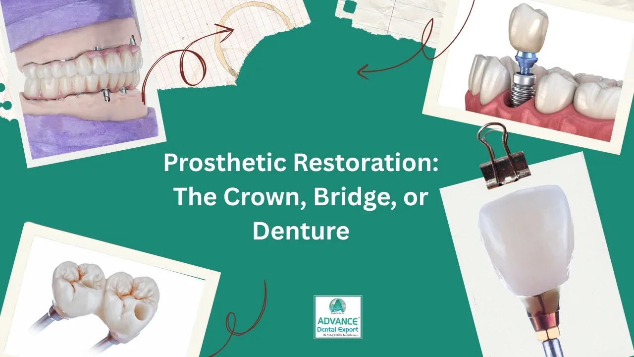 Prosthetic-Restoration-The-Crown-Bridge-or-Denture