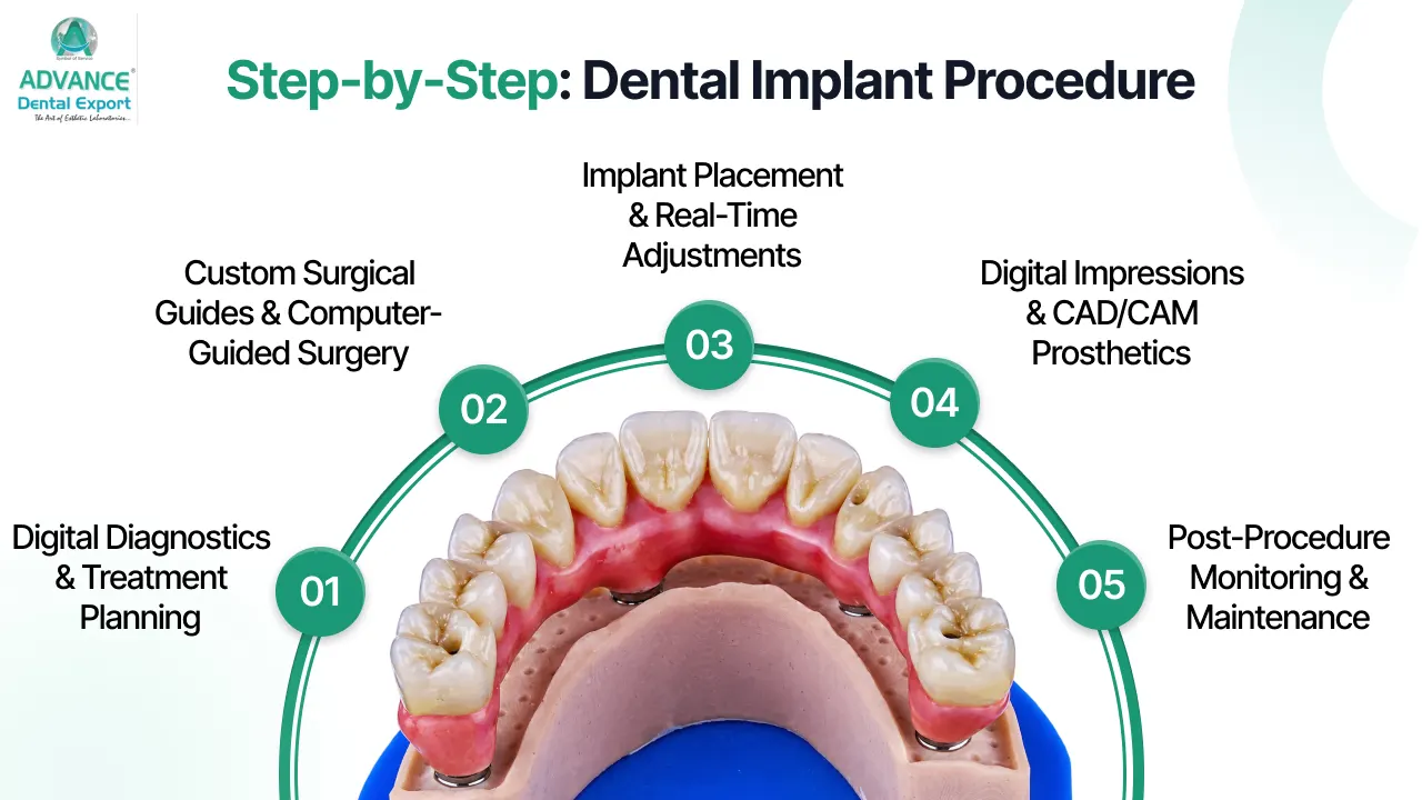 Step-by-Step-Dental-Implant-Procedure