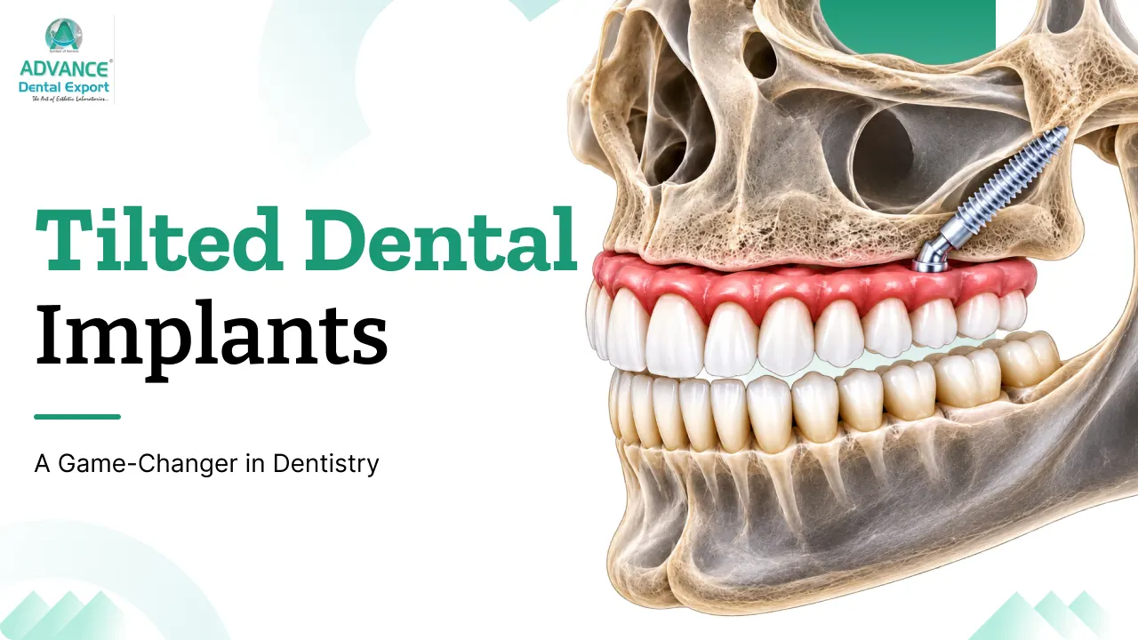 Tilted-Dental-Implants-A-Game-Changer-in-Dentistry