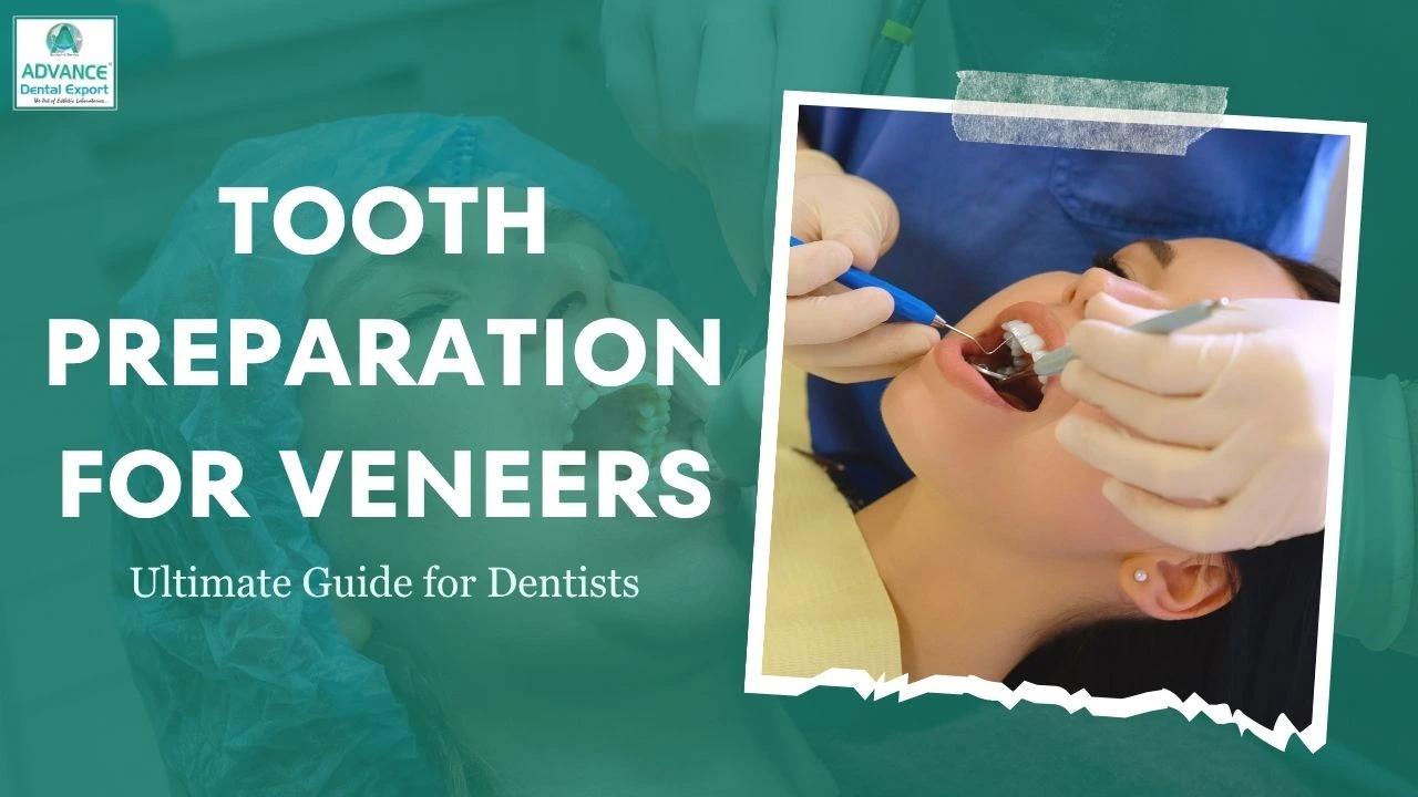 Tooth Preparation for Veneers: Ultimate Guide for Dentists
