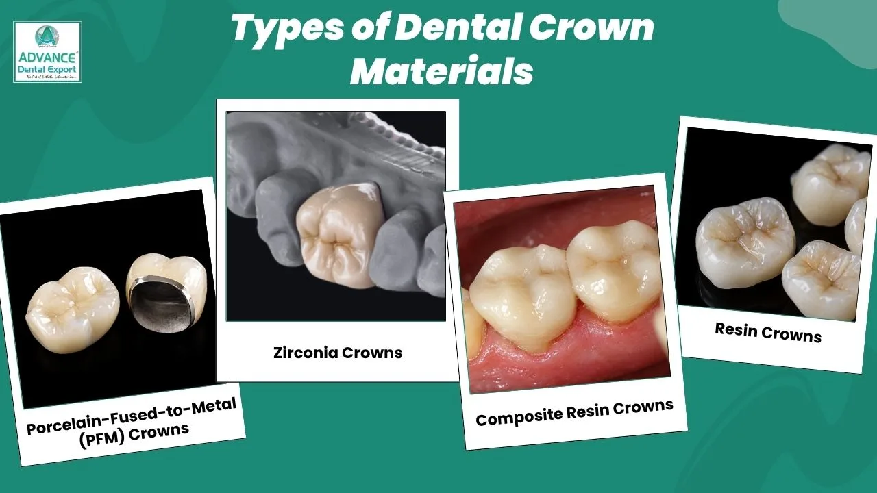 Types-of-Dental-Crown-Materials