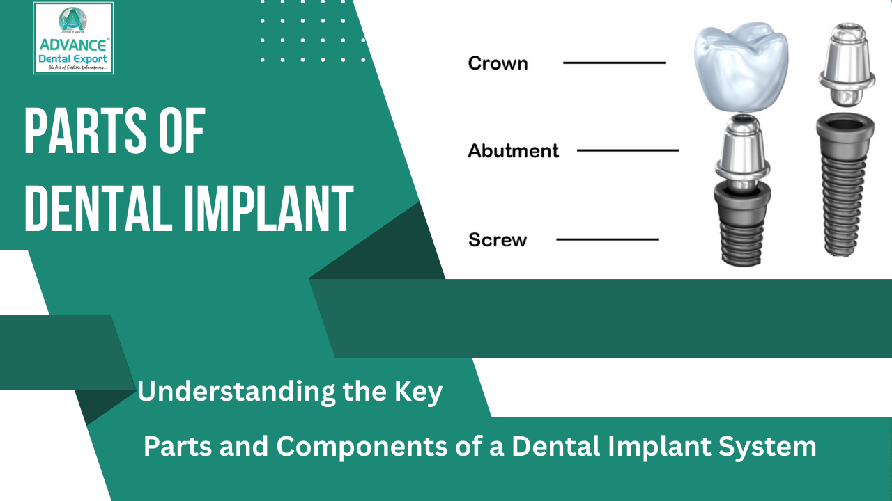 A Guide to Dental Implant System Key Parts & How They Work