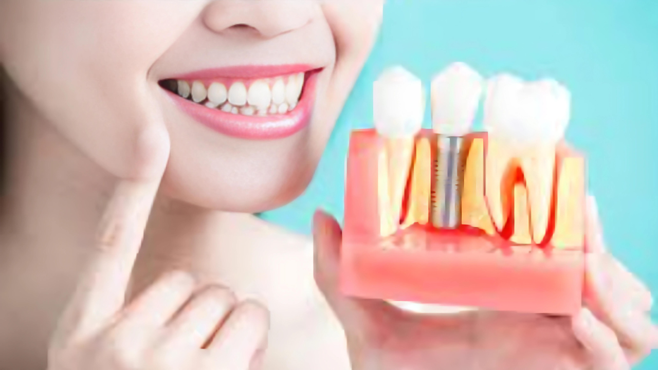 Healthy Dental Restorations
