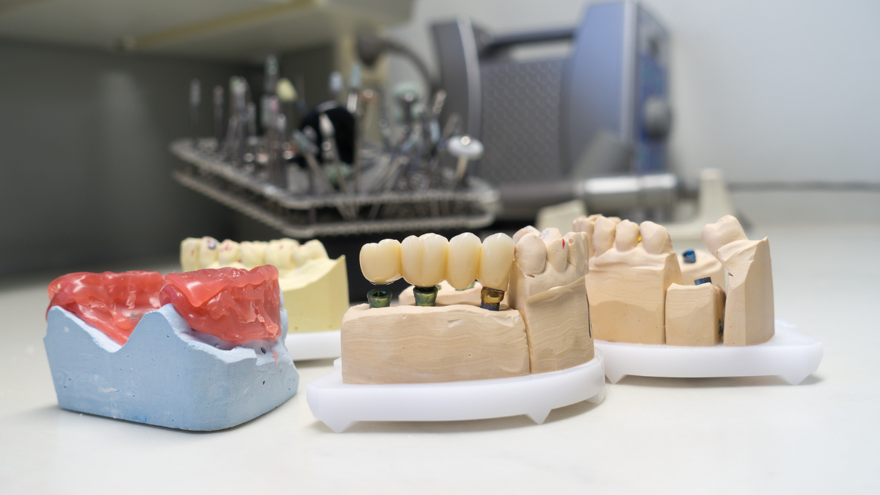 Unlocking the Power of Zirconia Crowns: A Dentist's Insight into Their Revolutionary Benefitss