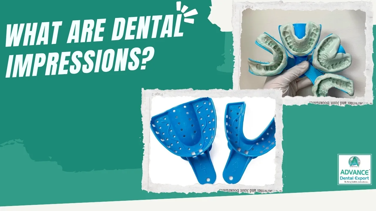 What-are-Dental-Impressions