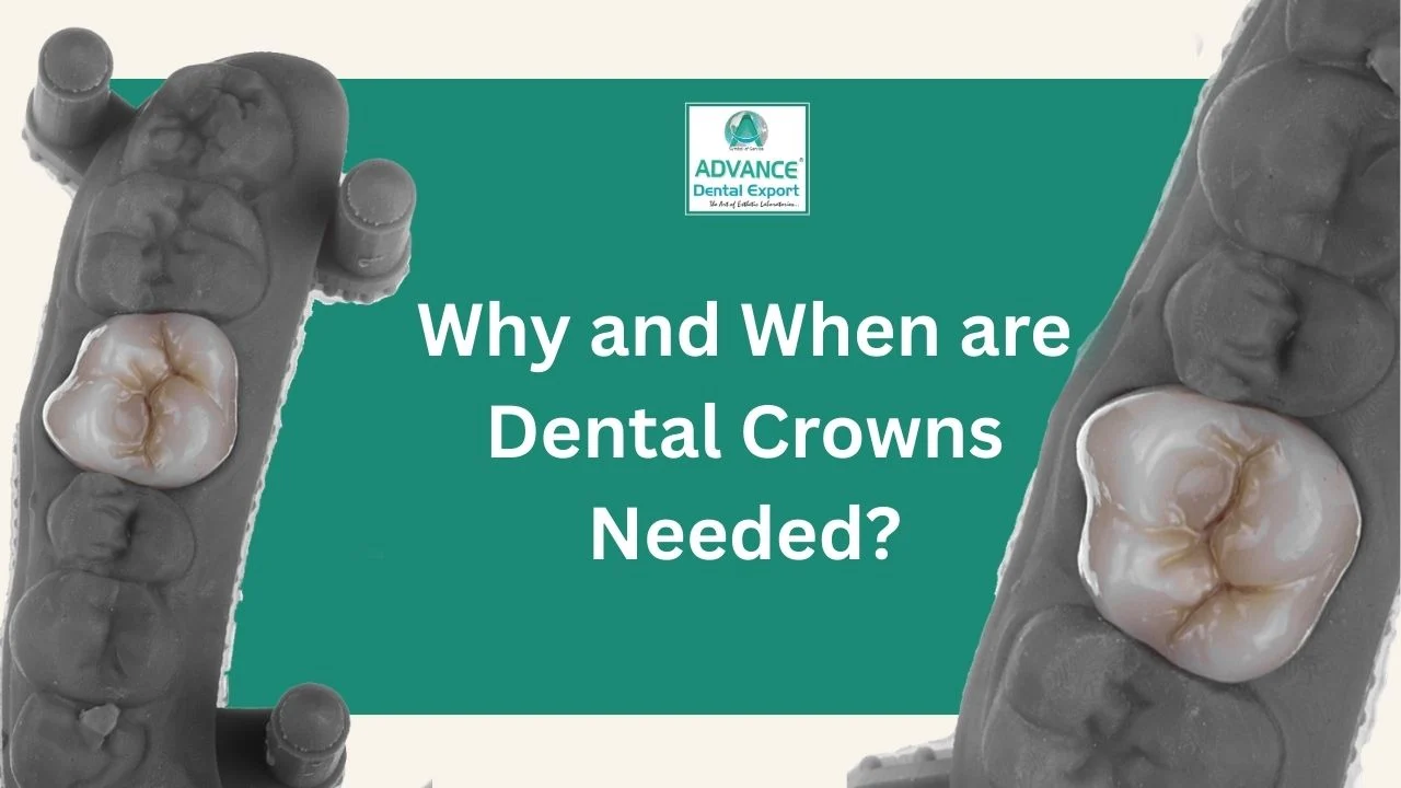 Why-an-Whe-are-Dental-Crowns-Needed