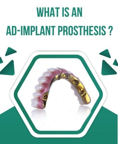 What is Ad-Implant? Benefits, Types, and Reasons