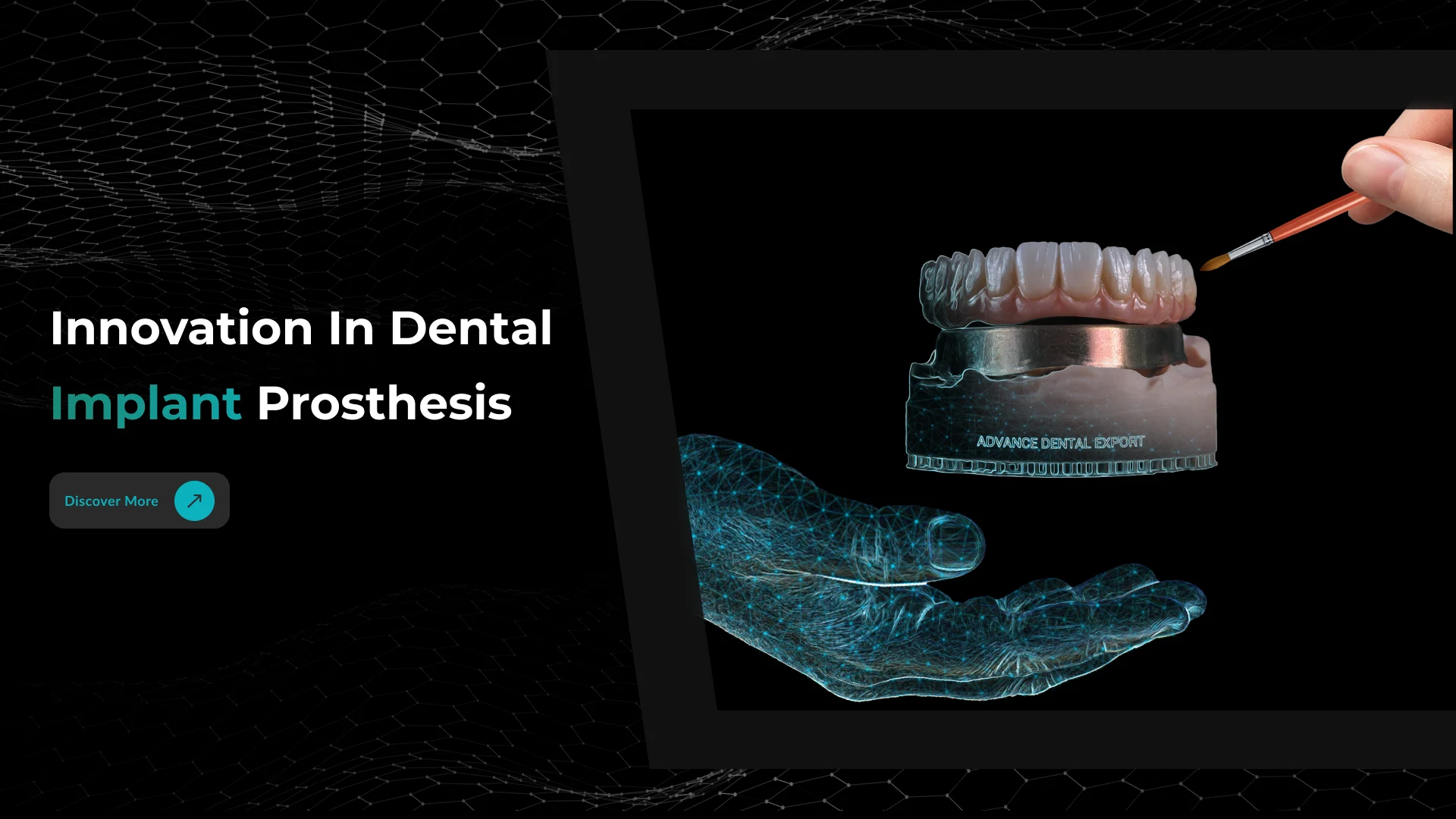 AD Implant banner showing dental implant placement concept for teeth restoration