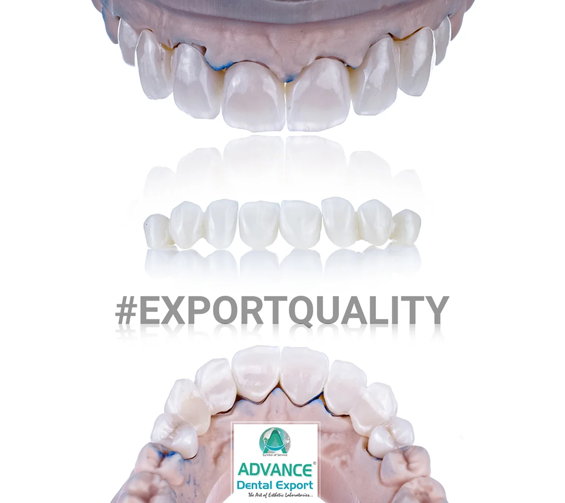 E-Max crowns